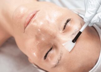 solutions for reducing melasma