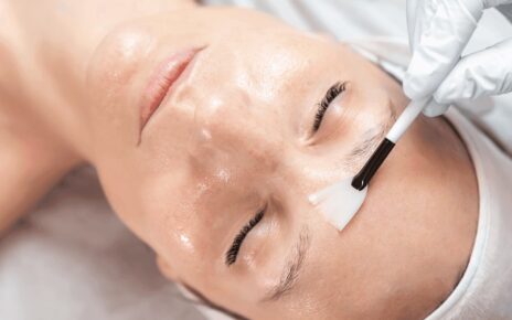 solutions for reducing melasma