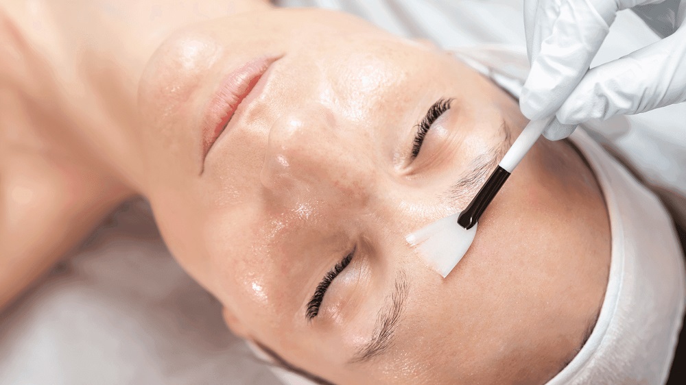 solutions for reducing melasma